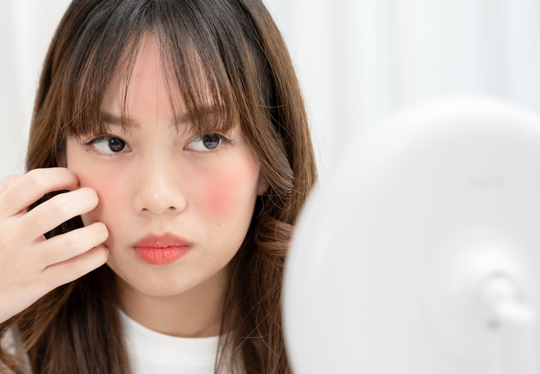 Dear My Friend! Here are some tips for Sensitive Skin Soothers: Ingredients to Calm and Heal