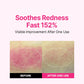ISOI Blemish Care Up Serum for Face