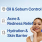 ISOI ACNI Dr. 1st Control Toner